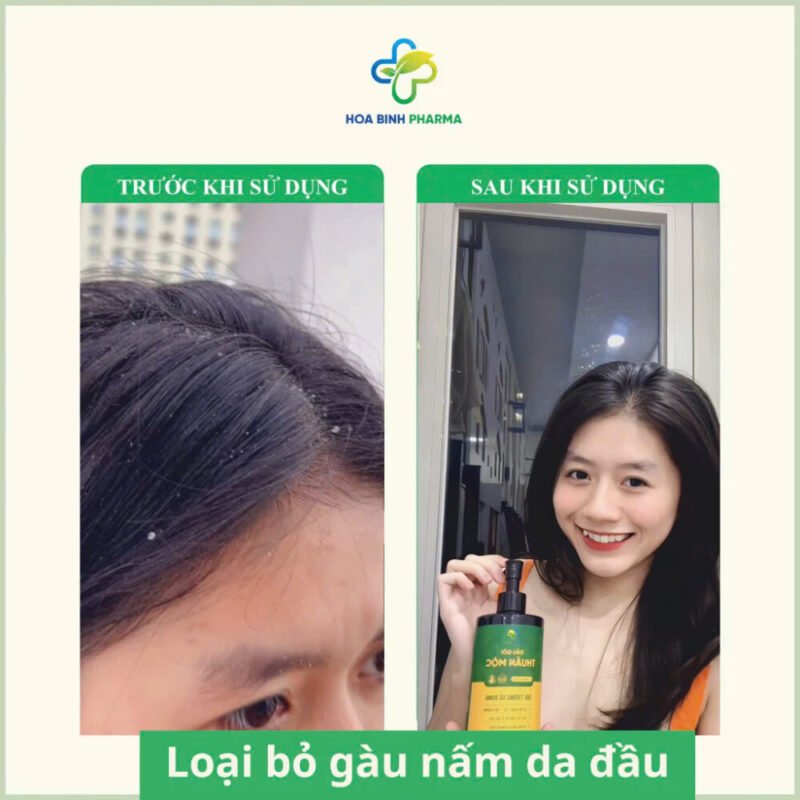 Dầu gội Thuần Mộc 300ml, Giúp làm sạch nấm da đầu, sạch gàu, trị rụng tóc - Hình ảnh 4